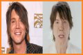 John Rzeznik Facelift | Goo Goo Dolls Frontman Plastic Surgery Before And After