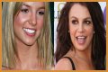 What’s Up with Britney Spears’ Smile? The Scoop on Her Noticeable Gap Teeth